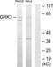 G Protein-Coupled Receptor Kinase 3 antibody, TA312914, Origene, Western Blot image 