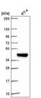 Interferon Induced Protein With Tetratricopeptide Repeats 5 antibody, PA5-66464, Invitrogen Antibodies, Western Blot image 