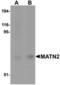 Matrilin 2 antibody, TA306751, Origene, Western Blot image 