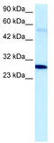 Poly(ADP-Ribose) Polymerase Family Member 11 antibody, TA334258, Origene, Western Blot image 