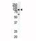 EPH Receptor A1 antibody, F50560-0.4ML, NSJ Bioreagents, Western Blot image 