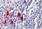 Chymase 1 antibody, NBP2-27551, Novus Biologicals, Immunohistochemistry paraffin image 