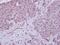 N(Alpha)-Acetyltransferase 15, NatA Auxiliary Subunit antibody, NBP2-19478, Novus Biologicals, Immunohistochemistry frozen image 