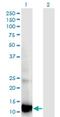 Retinol Binding Protein 5 antibody, H00083758-M05, Novus Biologicals, Western Blot image 