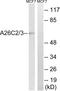 POTE Ankyrin Domain Family Member H antibody, LS-C120253, Lifespan Biosciences, Western Blot image 