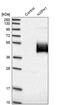 Neurexophilin 1 antibody, PA5-54134, Invitrogen Antibodies, Western Blot image 