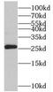 GP25L2 antibody, FNab08741, FineTest, Western Blot image 