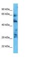 Coiled-Coil Domain Containing 181 antibody, orb326211, Biorbyt, Western Blot image 