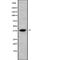 Acyl-CoA Wax Alcohol Acyltransferase 2 antibody, abx148470, Abbexa, Western Blot image 