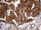 Phosphatidylinositol-4-Phosphate 3-Kinase Catalytic Subunit Type 2 Alpha antibody, LS-C789282, Lifespan Biosciences, Immunohistochemistry paraffin image 