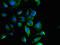 A-Kinase Anchoring Protein 17A antibody, orb47543, Biorbyt, Immunocytochemistry image 