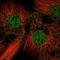 LRAT Domain Containing 2 antibody, NBP2-57217, Novus Biologicals, Immunofluorescence image 