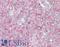 Signal Induced Proliferation Associated 1 Like 3 antibody, LS-B15493, Lifespan Biosciences, Immunohistochemistry paraffin image 