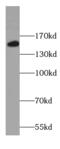 Collagen Type XVI Alpha 1 Chain antibody, FNab01848, FineTest, Western Blot image 