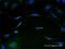 Mitochondrial Ribosomal Protein L1 antibody, H00065008-M02, Novus Biologicals, Immunocytochemistry image 