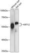 Keratin 12 antibody, GTX66286, GeneTex, Western Blot image 