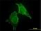Calcium And Integrin Binding 1 antibody, H00010519-M01, Novus Biologicals, Immunofluorescence image 