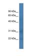 TATA-Box Binding Protein Associated Factor 12 antibody, orb329597, Biorbyt, Western Blot image 