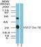 Heat Shock Protein Family B (Small) Member 1 antibody, PA5-23340, Invitrogen Antibodies, Western Blot image 