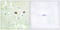 Protein Tyrosine Phosphatase Non-Receptor Type 1 antibody, LS-C199502, Lifespan Biosciences, Immunohistochemistry paraffin image 