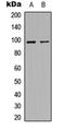 MET Transcriptional Regulator MACC1 antibody, orb256663, Biorbyt, Western Blot image 