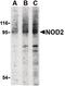 Nucleotide Binding Oligomerization Domain Containing 2 antibody, PA5-19991, Invitrogen Antibodies, Western Blot image 