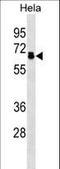 Protein Phosphatase 2 Regulatory Subunit B'Delta antibody, LS-C158717, Lifespan Biosciences, Western Blot image 