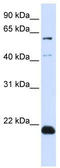 Chromosome 14 Open Reading Frame 180 antibody, TA336146, Origene, Western Blot image 