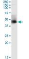 Armadillo Repeat Containing 8 antibody, H00025852-M01, Novus Biologicals, Immunoprecipitation image 