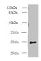 C-Type Lectin Domain Family 4 Member E antibody, orb354395, Biorbyt, Western Blot image 