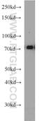 Synoviolin 1 antibody, 13473-1-AP, Proteintech Group, Western Blot image 