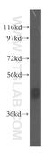 Jumonji Domain Containing 6, Arginine Demethylase And Lysine Hydroxylase antibody, 16476-1-AP, Proteintech Group, Western Blot image 