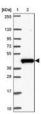 Chromosome 19 Open Reading Frame 54 antibody, NBP2-32418, Novus Biologicals, Western Blot image 