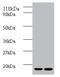 Beta-2-Microglobulin antibody, A57870-100, Epigentek, Western Blot image 