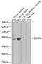 Interleukin 11 Receptor Subunit Alpha antibody, GTX33258, GeneTex, Western Blot image 