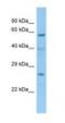 RNA Transcription, Translation And Transport Factor antibody, NBP1-98258, Novus Biologicals, Western Blot image 