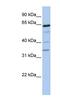Polypeptide N-Acetylgalactosaminyltransferase 16 antibody, NBP1-59987, Novus Biologicals, Western Blot image 