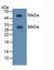 R-spondin-1 antibody, LS-C705572, Lifespan Biosciences, Western Blot image 