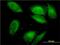 Seryl-TRNA Synthetase antibody, H00006301-M01, Novus Biologicals, Immunofluorescence image 