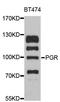 Progesterone Receptor antibody, LS-C746725, Lifespan Biosciences, Western Blot image 