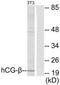 Choriogonadotropin subunit beta antibody, TA313616, Origene, Western Blot image 
