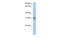 TRNA Methyltransferase 10B antibody, 29-501, ProSci, Enzyme Linked Immunosorbent Assay image 