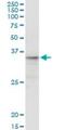 Cell Growth Regulator With EF-Hand Domain 1 antibody, H00010669-M01, Novus Biologicals, Immunoprecipitation image 