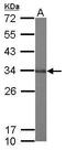 Glyoxalase Domain Containing 4 antibody, TA308064, Origene, Western Blot image 