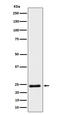 Muscle RAS Oncogene Homolog antibody, M06332-1, Boster Biological Technology, Western Blot image 