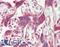 NFKB Inhibitor Alpha antibody, LS-B12432, Lifespan Biosciences, Immunohistochemistry paraffin image 