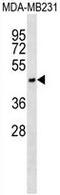 Asialoglycoprotein Receptor 1 antibody, AP50272PU-N, Origene, Western Blot image 