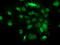 Glutathione S-Transferase Theta 2 (Gene/Pseudogene) antibody, LS-C115738, Lifespan Biosciences, Immunofluorescence image 