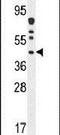 DnaJ Heat Shock Protein Family (Hsp40) Member C22 antibody, PA5-24357, Invitrogen Antibodies, Western Blot image 