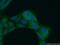 Lymphocyte Transmembrane Adaptor 1 antibody, 21557-1-AP, Proteintech Group, Immunofluorescence image 